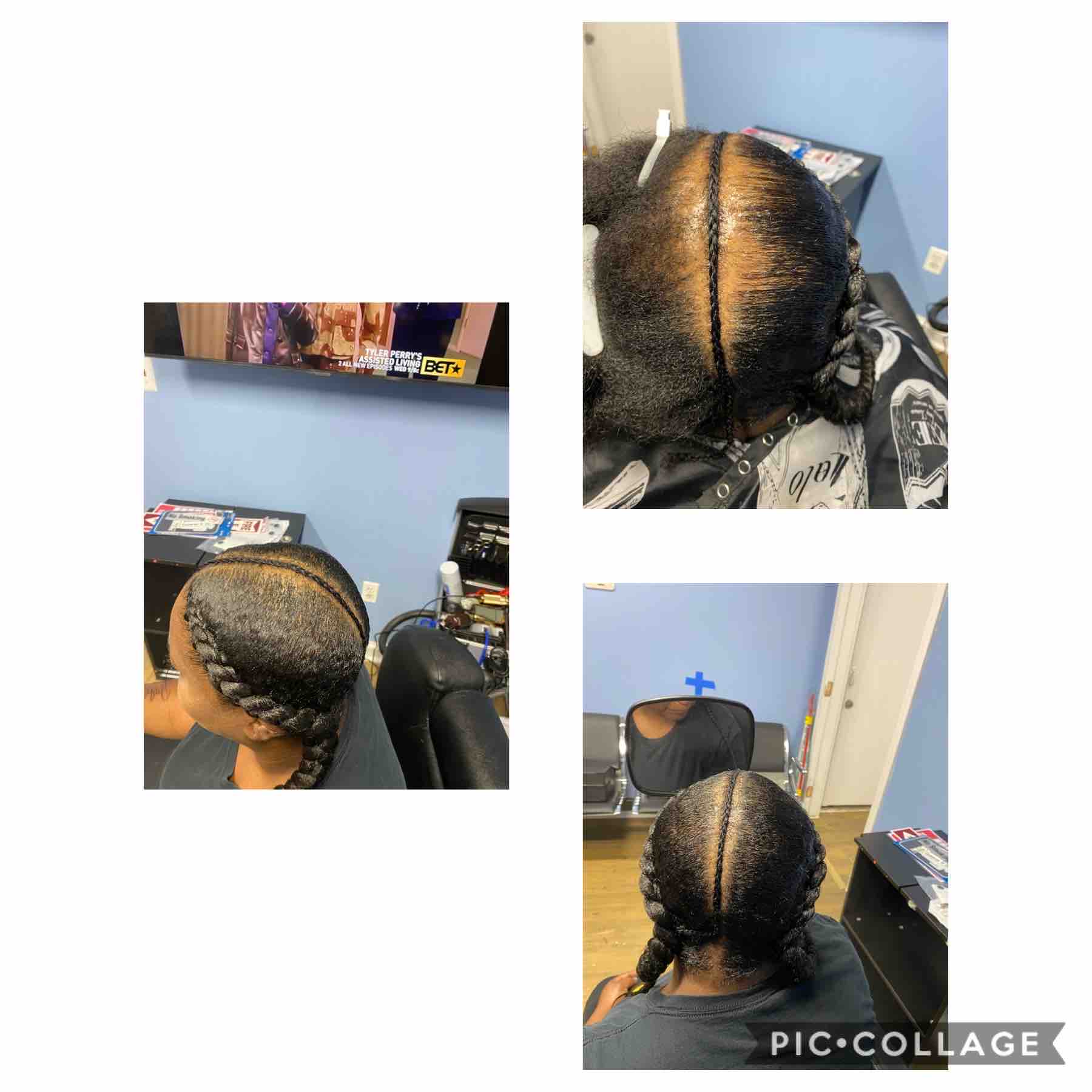 Hair Folicles Added