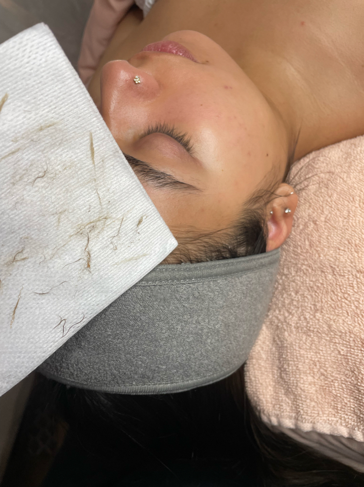 ✨Sunkissed Dermaplane Facial