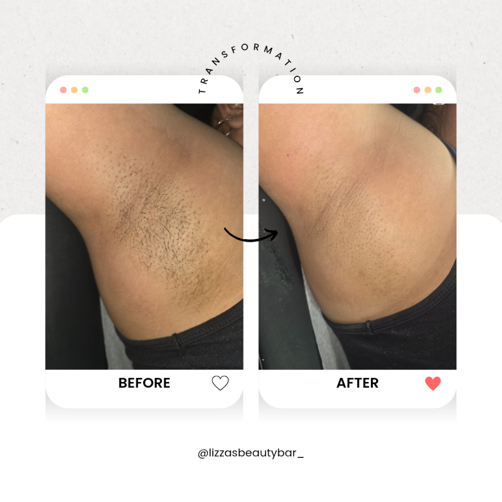 Underarm Wax at Lizza's Beauty Bar in Milpitas, CA