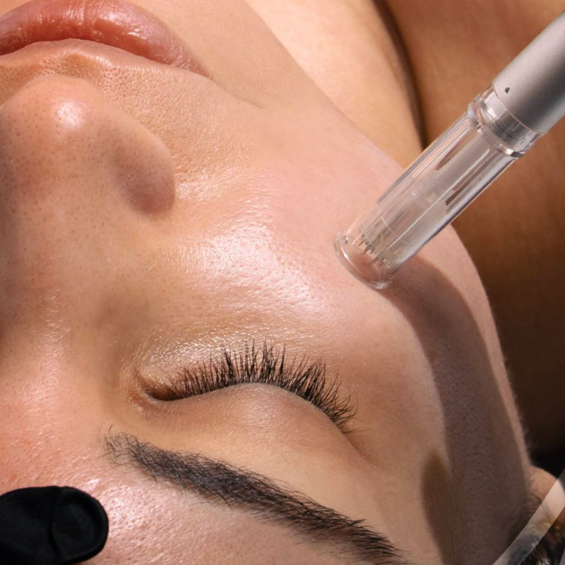 Microneedling Face ONLY