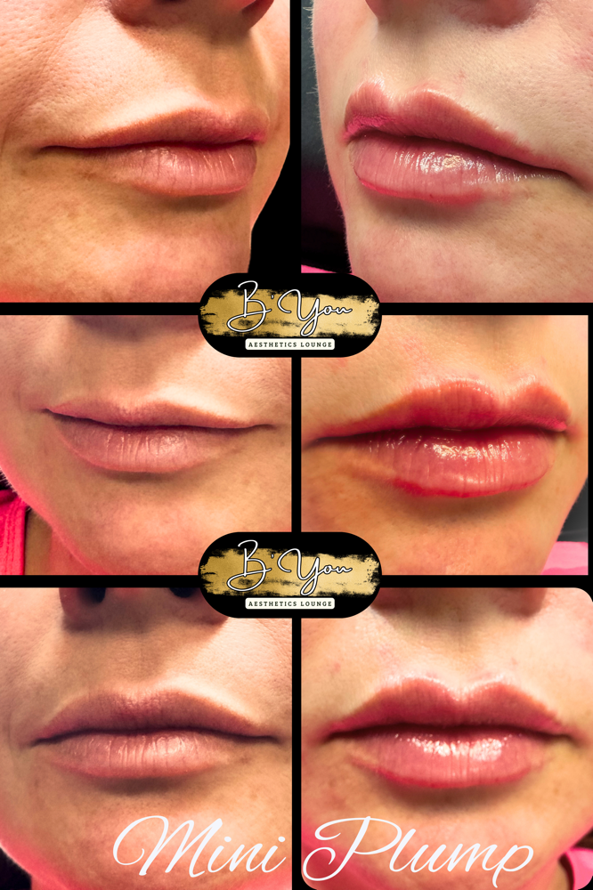 Revanesse Lips+