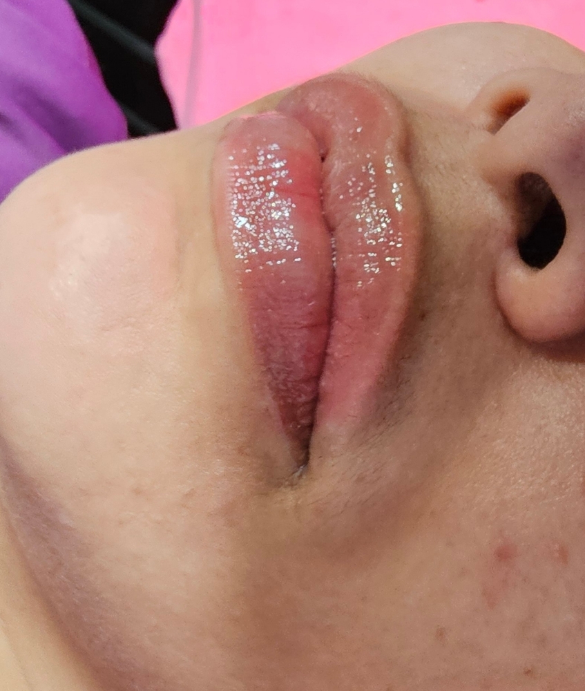 Labios  A.H .1ml