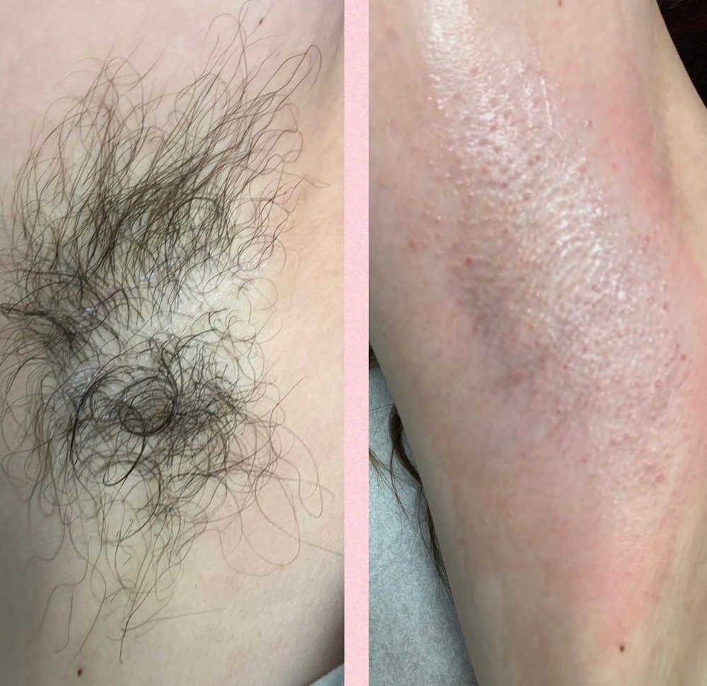 Underarm Wax