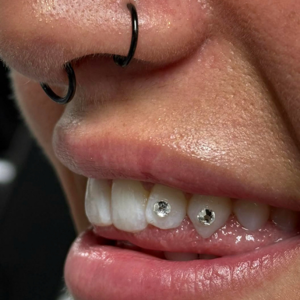 Tooth Gem 💎 at Radiance Skin in Pensacola, FL