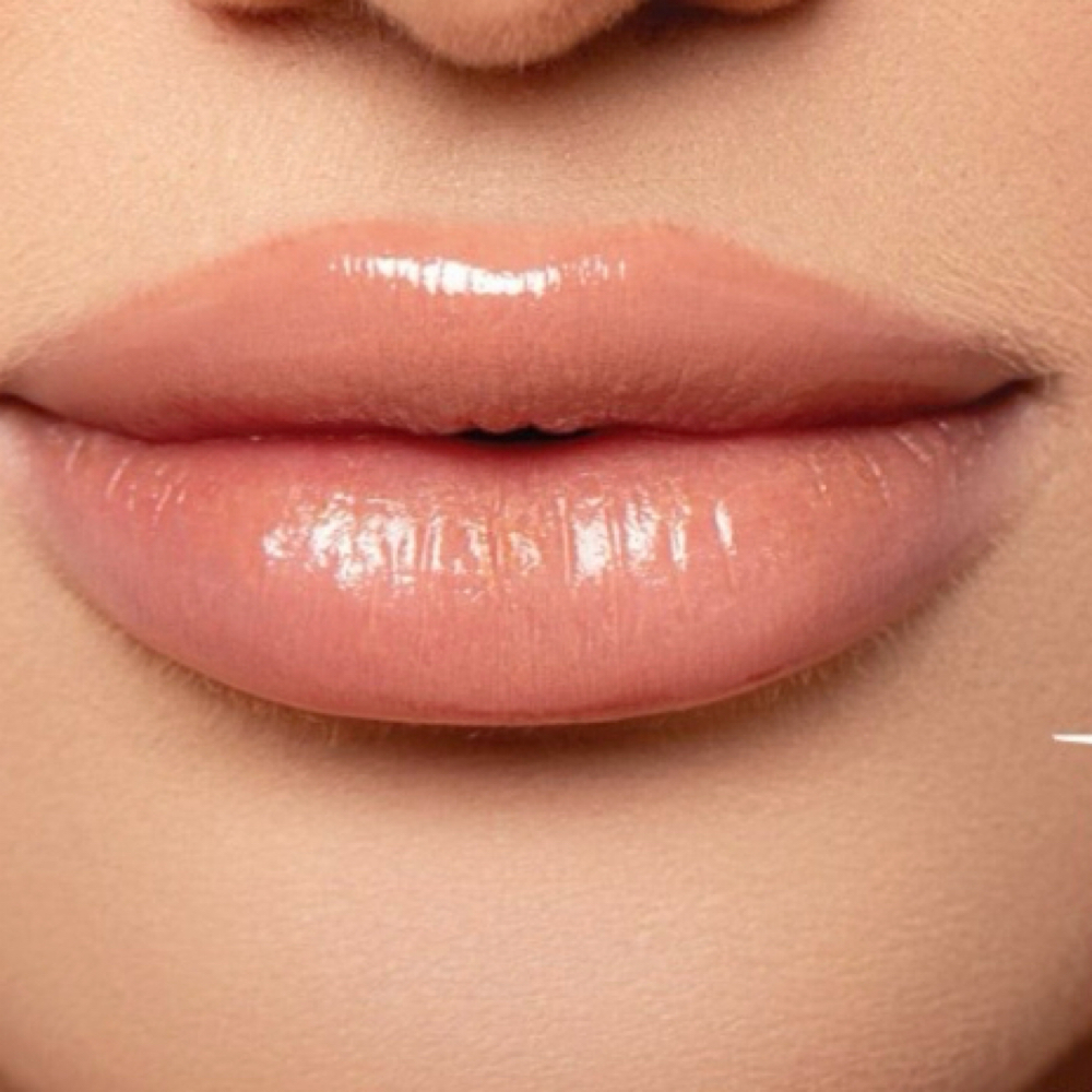 Lip Filler (Full Syringe) Juvederm at Radiant Aesthetics by Liz in El Paso, TX