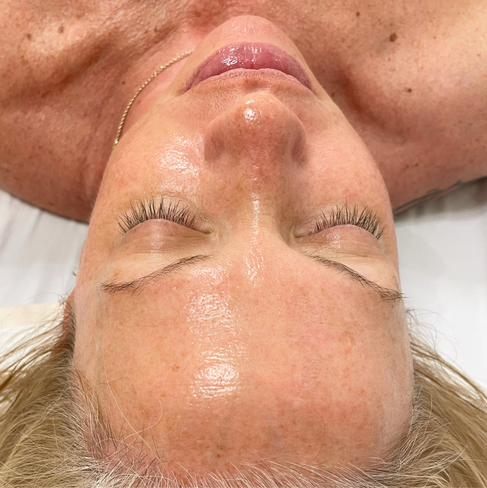 Custom Glow Facial