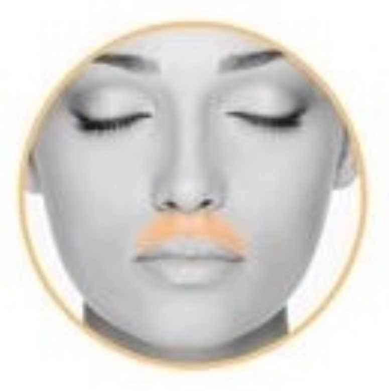 UPPER LIP Laser Hair Removal