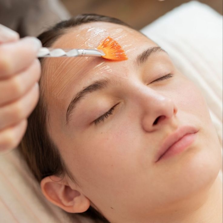 Chemical Peel at REVIVD Aesthetics & Wellness in Mission, TX