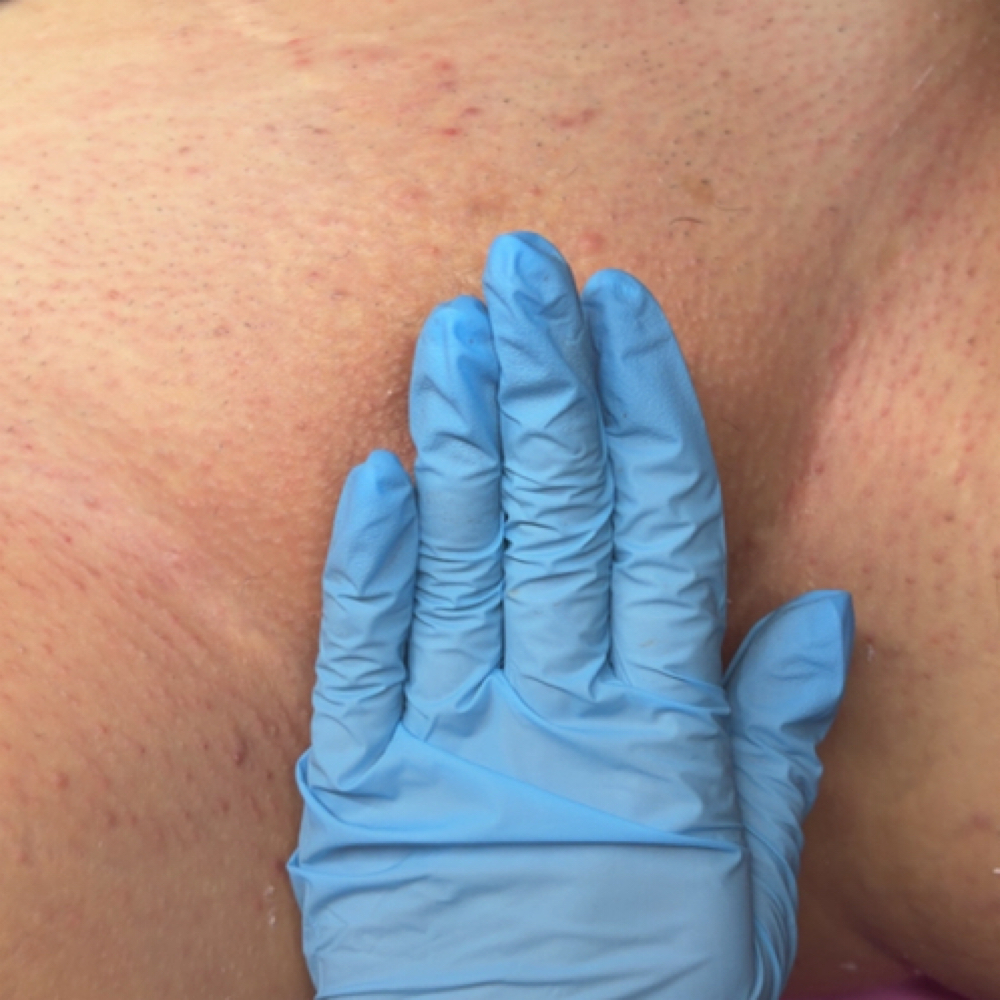 Brazilian wax at Bae's Beauty Esthetics in Milan, TN