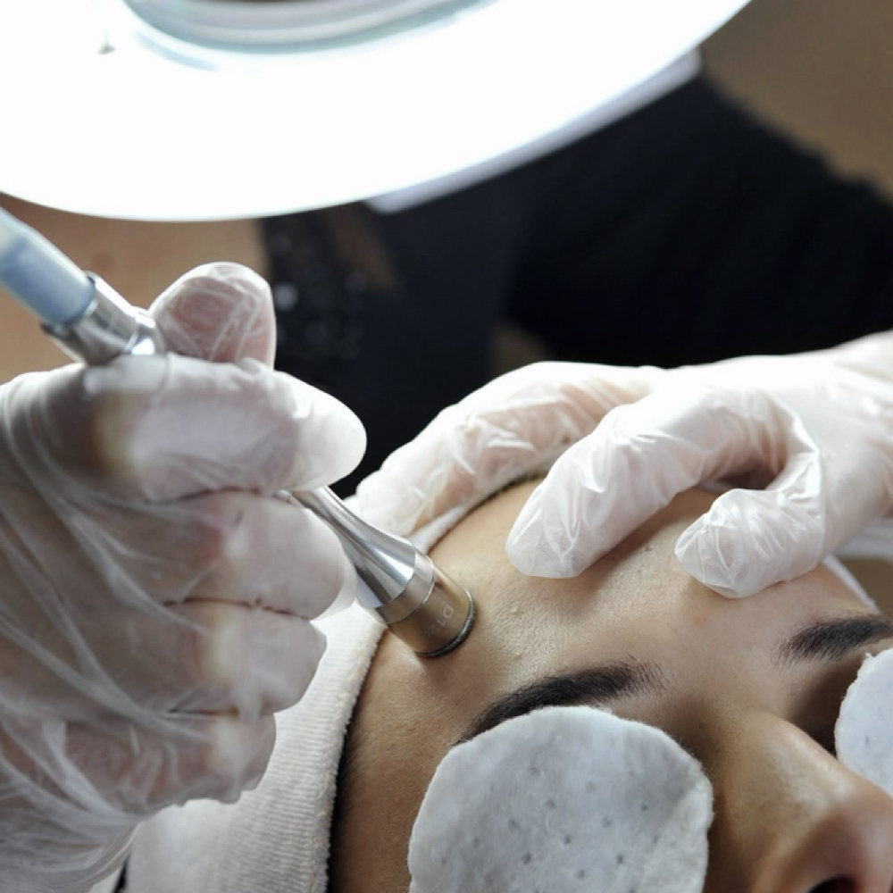 Microdermabrasion Facial at Divinely Created Skin in Friendswood, TX