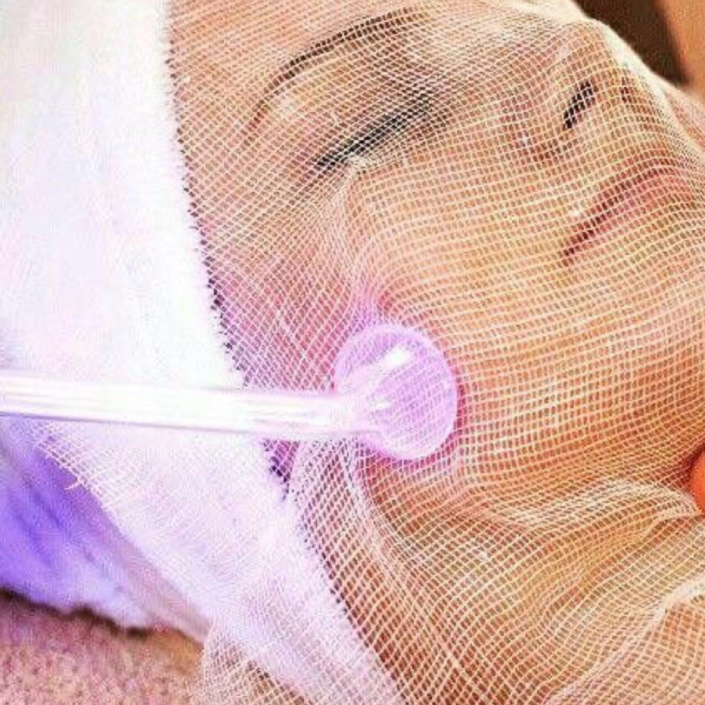 High frequency Add On at Skin Theory By Heather Ferrato LLC in Dover, FL