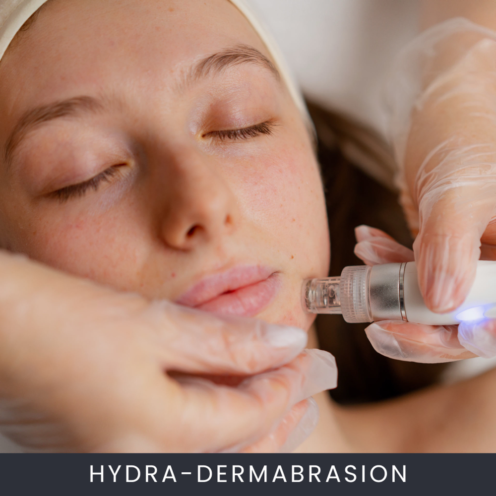 Hydradermabrasion Peel