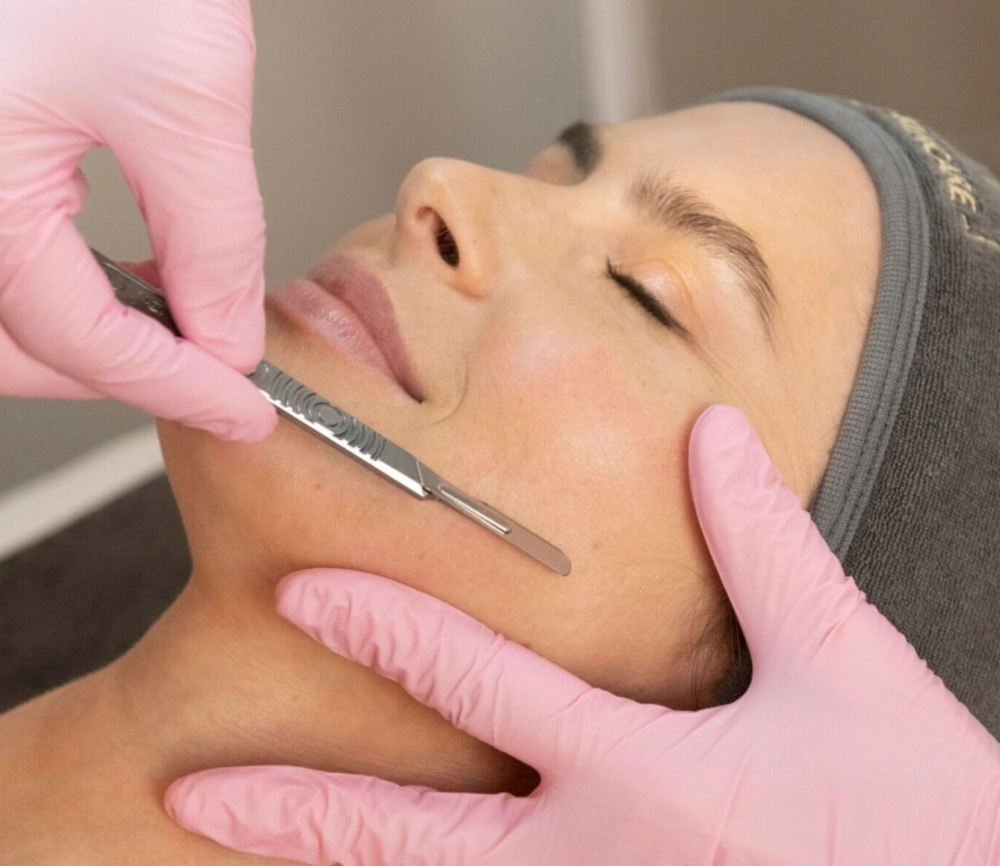 Add on- Dermaplane