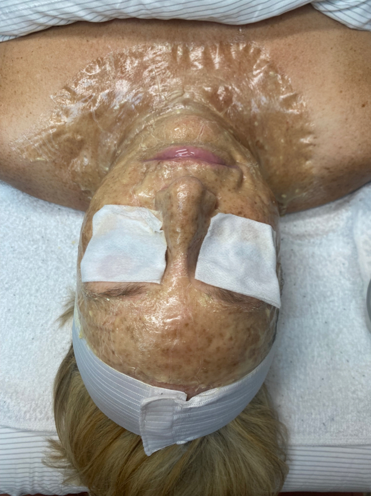 Firming Peptide Treatment
