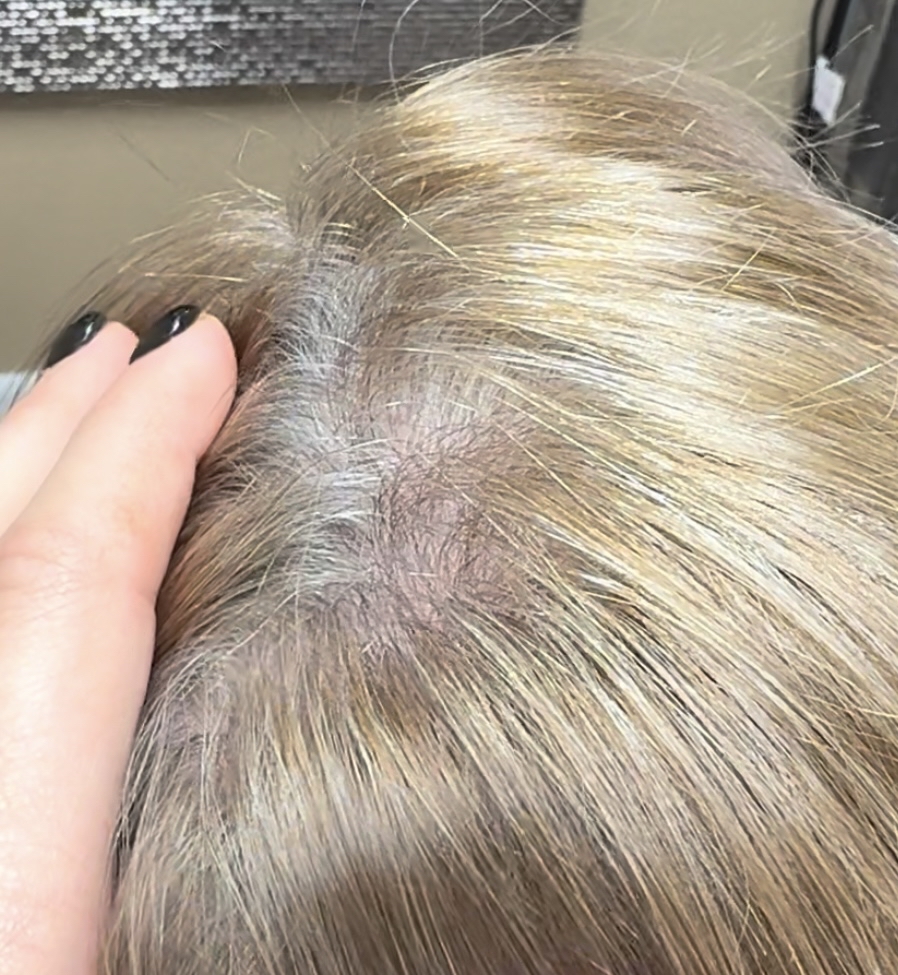 Volumizing Root Lift