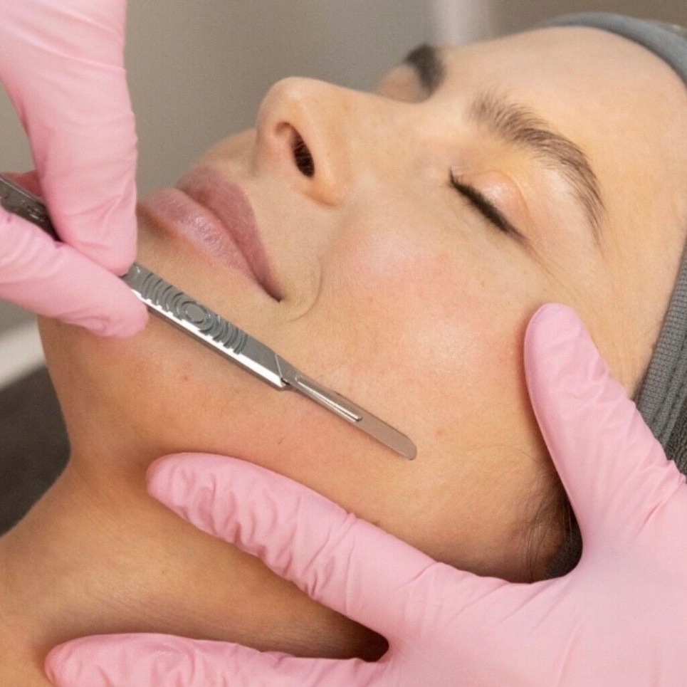 Dermaplane Add on at The Allure Aesthetic in Columbia, MD