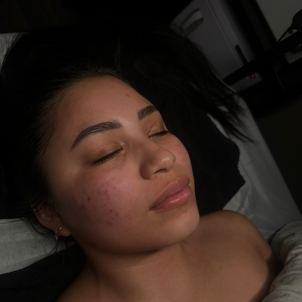 Firm & Tighten Anti-Aging Skin Trea at Radiant Beauty & Jewelry in Laramie, WY