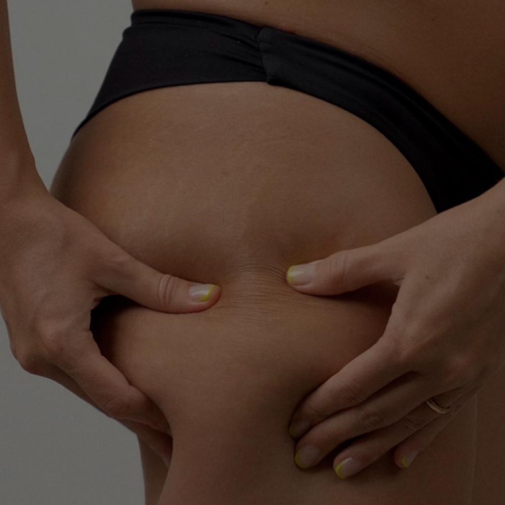 Endermologie Cellulite Treatment at AZ Body Bar-Gilbert in Gilbert, AZ