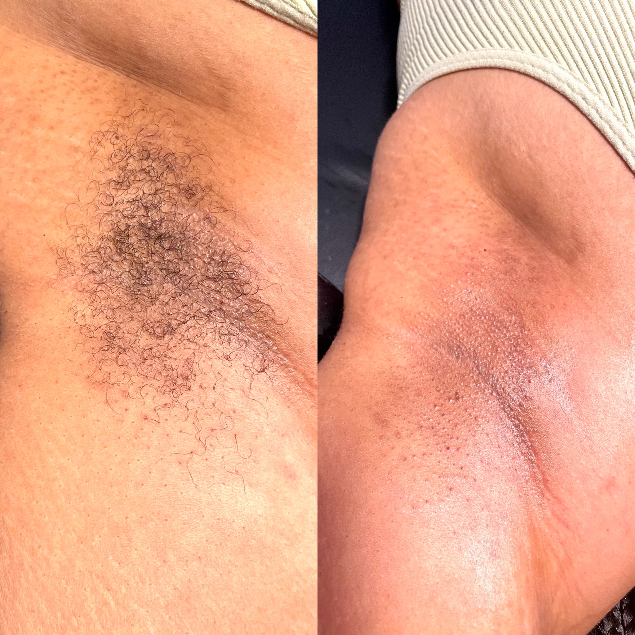 Underarm Wax at Flawless By Fabiola in Baldwin, NY