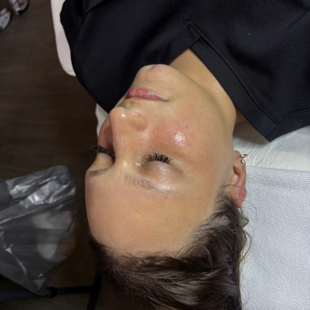 the signature skin treatment⭐️ at Syd Skin Studio | Pgh Facial+Lash/Brow Bar in Gibsonia, PA