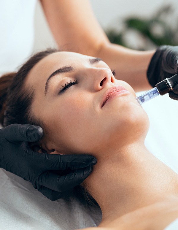Microneedling w/ Rejuran Booster at Revital Med Aesthetics & Wellness in Oceanside, NY
