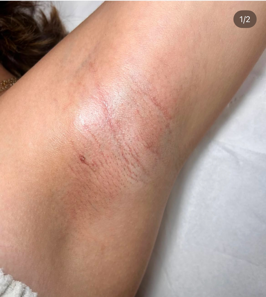 Underarm Wax at Karol’s Beauty Bar in Oswego, IL