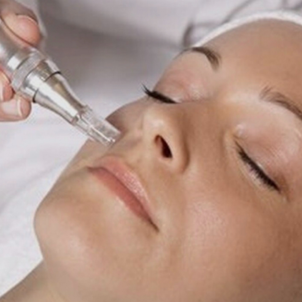 Nano Infusion Add-On at Beyond Beauty & Glow in Lincolnshire, IL