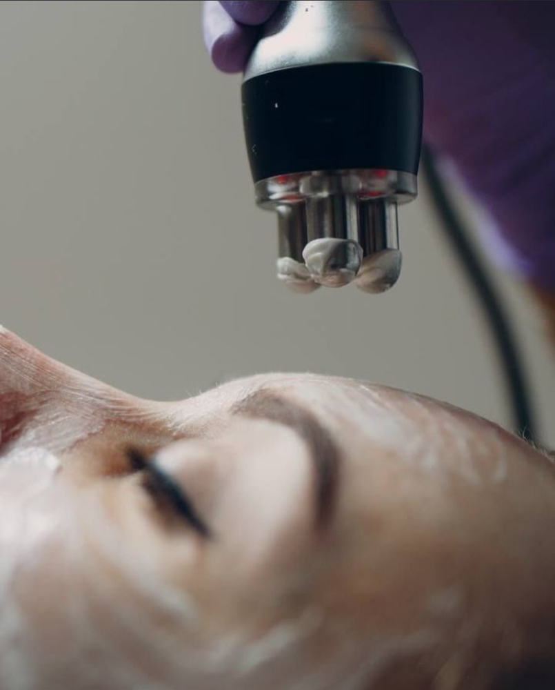 Skin Tightning Facial