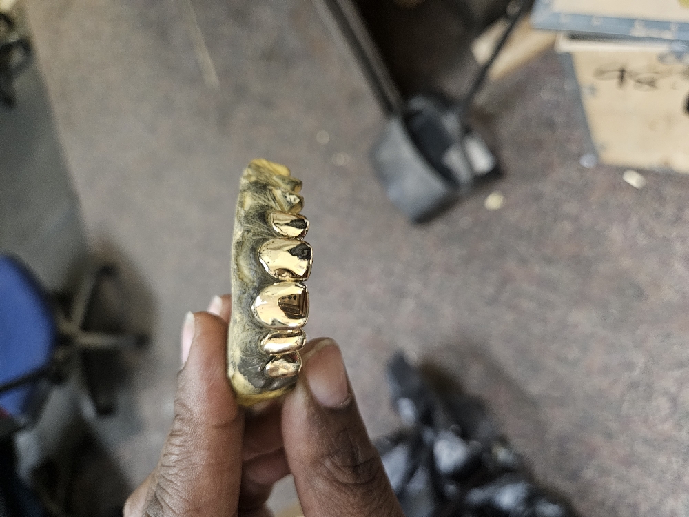 18k Gold Grill Per Tooth