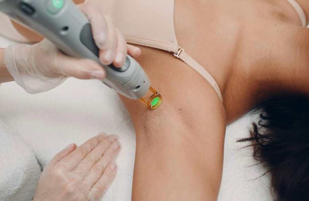 Underarms Laser Hair Removal (singl