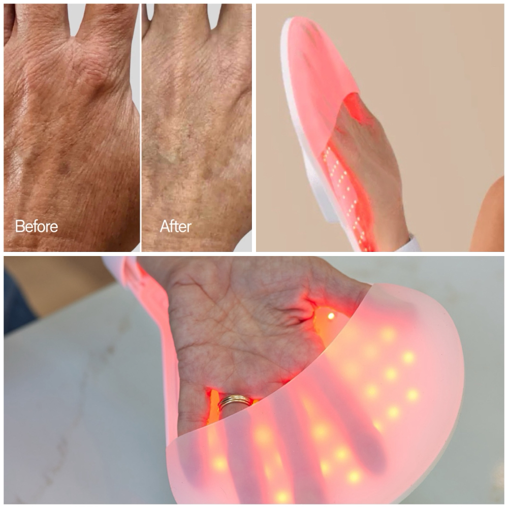 Red Light Therapy Gloves (NEW)