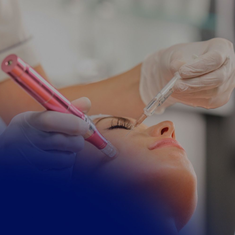 Exosome Regenerative Microneedling at Face & Grace Aesthetics in Temecula, CA