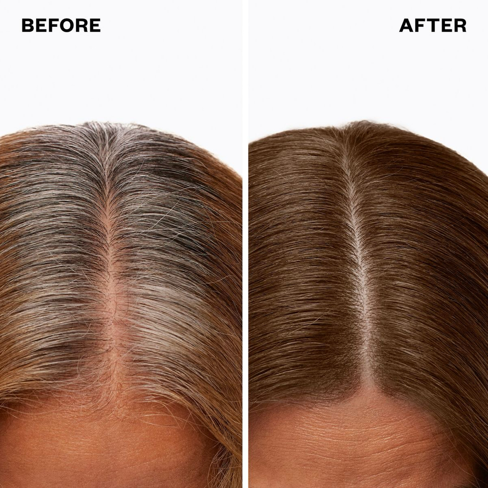 Women’s Gray Root Coverage
