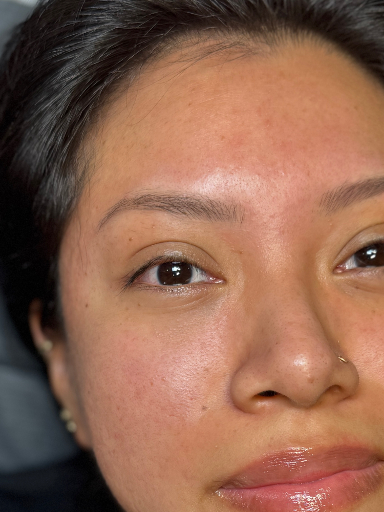 Eyelash Removal