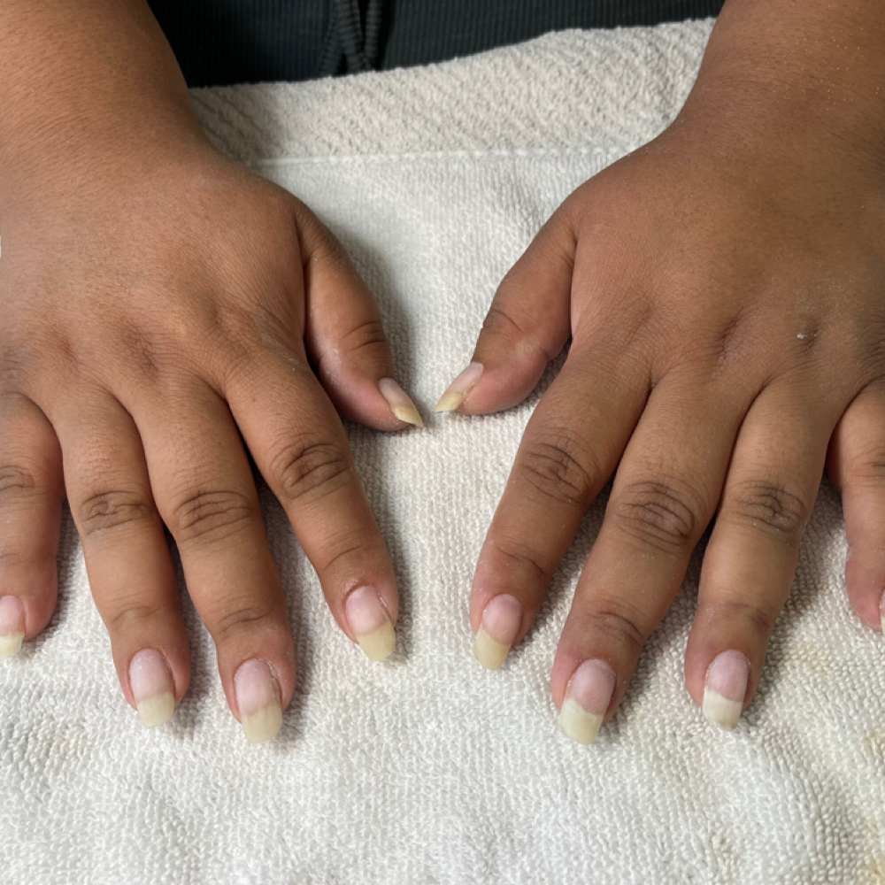 Removal at Le Chic Beauty LLC in Boise, ID