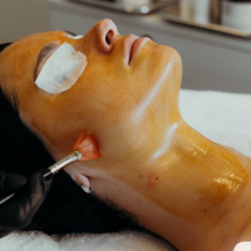 Customized Chemical Peel at Skin Theory - Logan in Perry, FL
