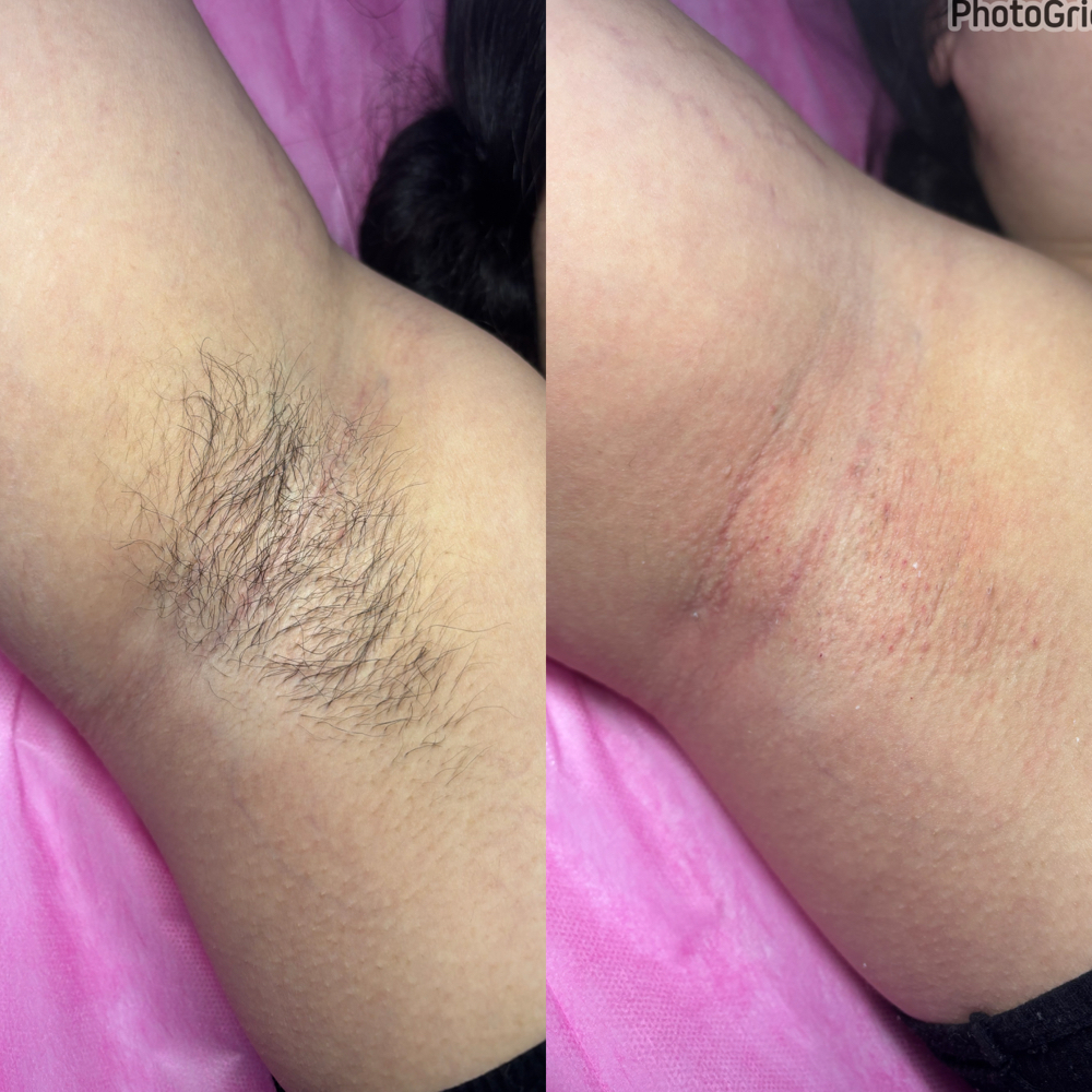 Under Arms Wax (Armpits)