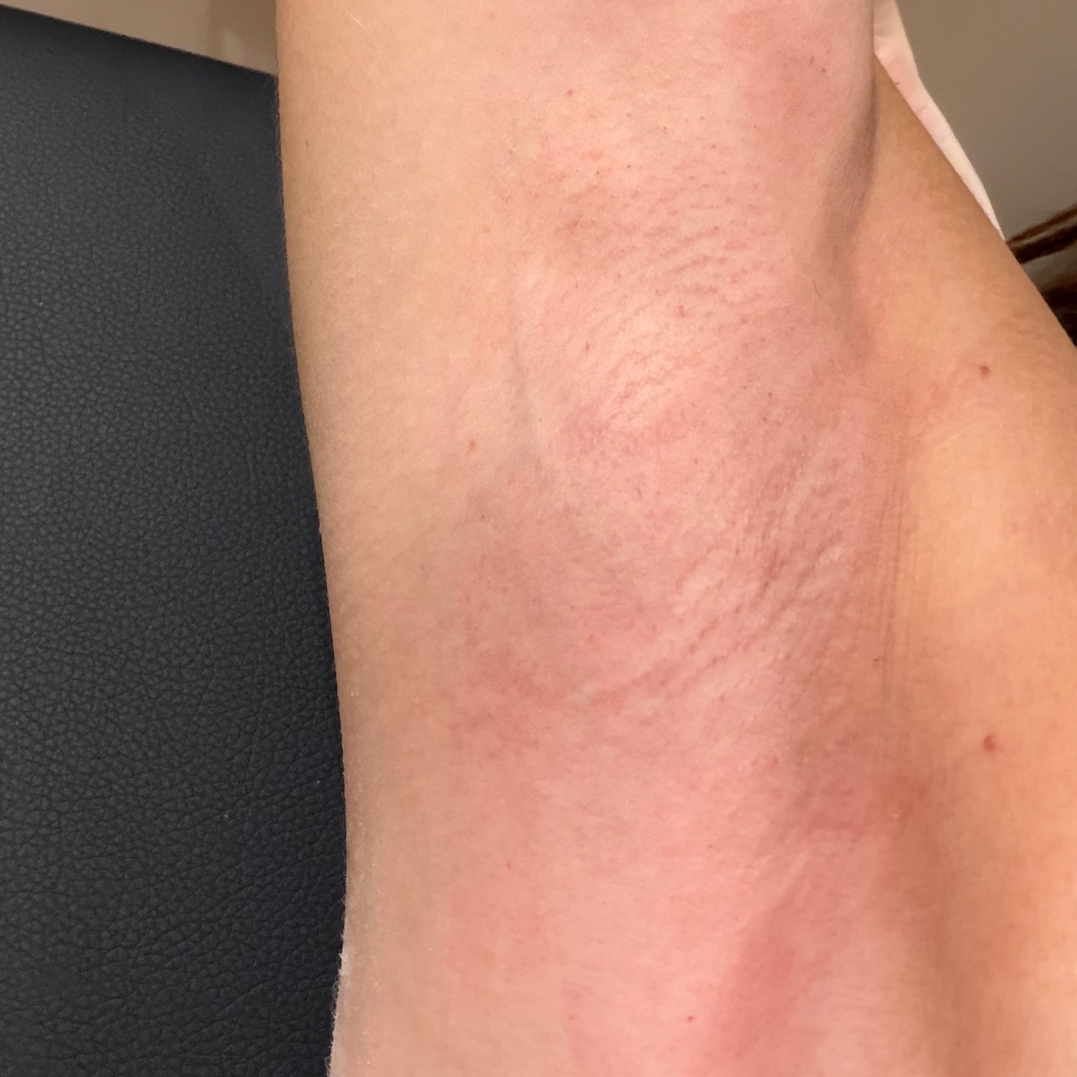 Underarm Wax at Enhanced Esthetics by EmMUA in Marietta, OH