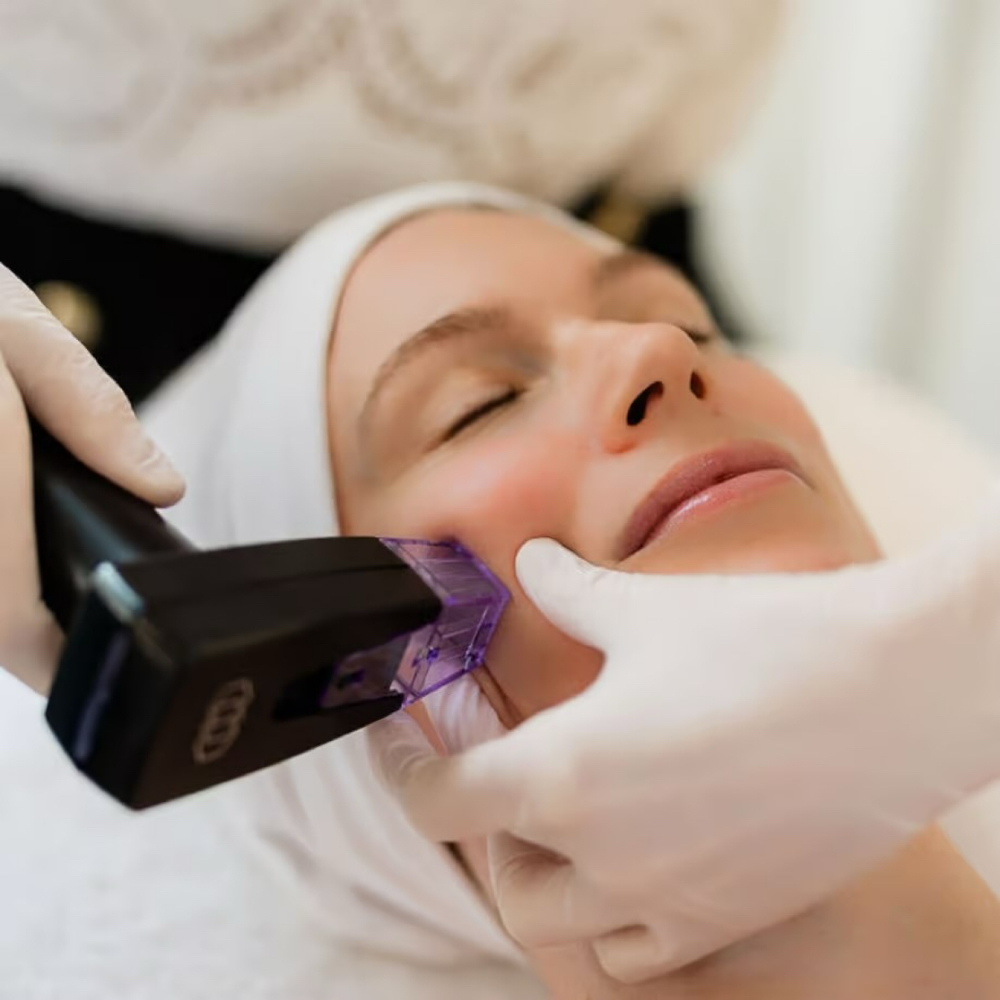 RF FACE at MB BEAUTY CLINIC | AESTHETICS | PMU in Nantucket, MA