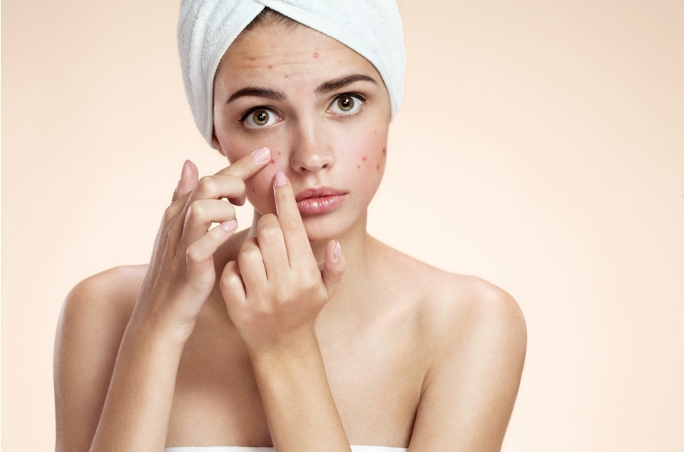 Intensive Acne Treatment