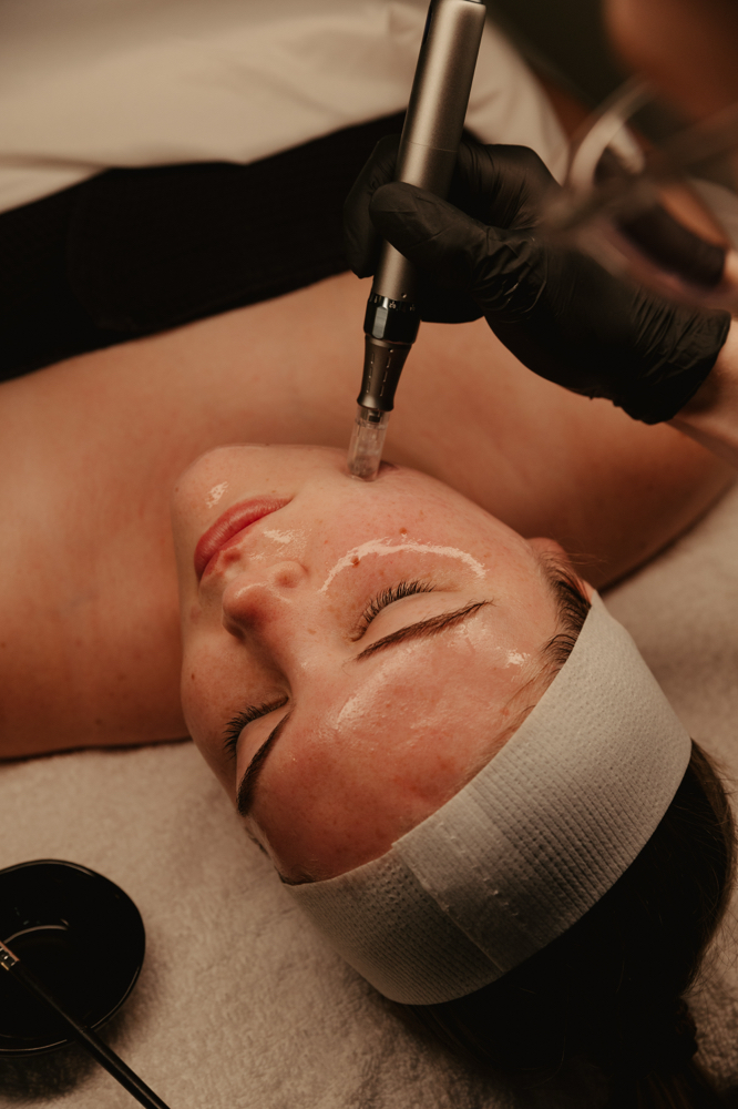Ressurect Microneedling Facial