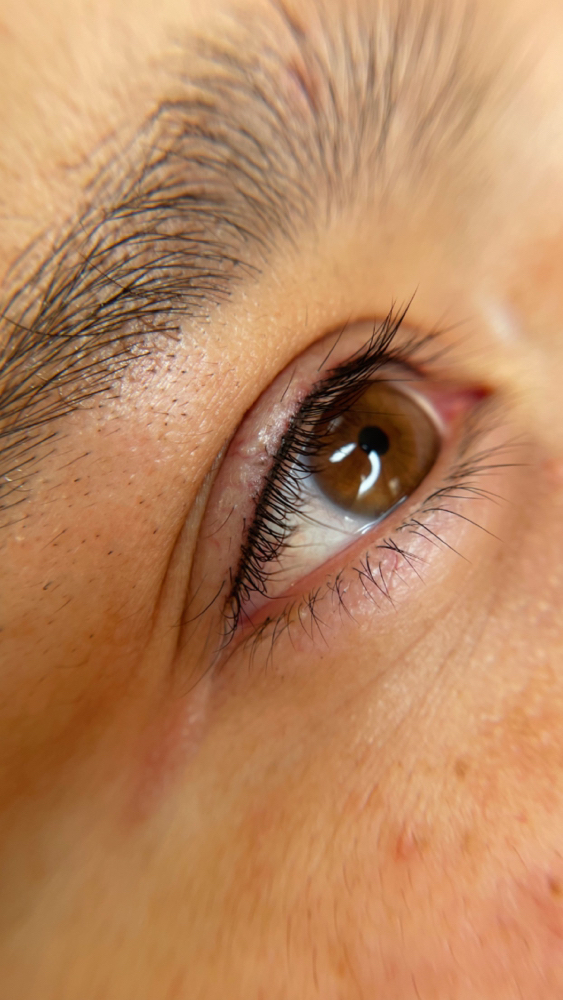 Lash Enhancement