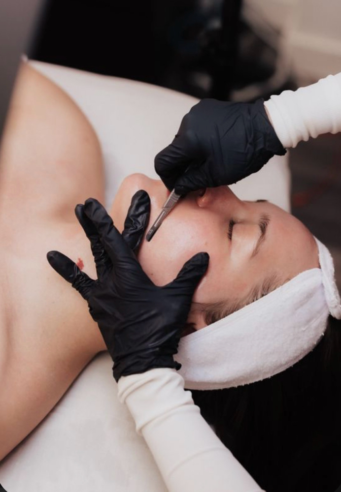 Express Dermaplane