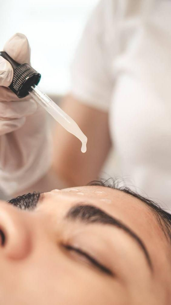 Chemical Peel Facial