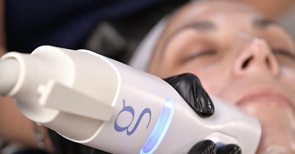 Glacial Gloss at VOGUE AESTHETICS in Okeechobee, FL