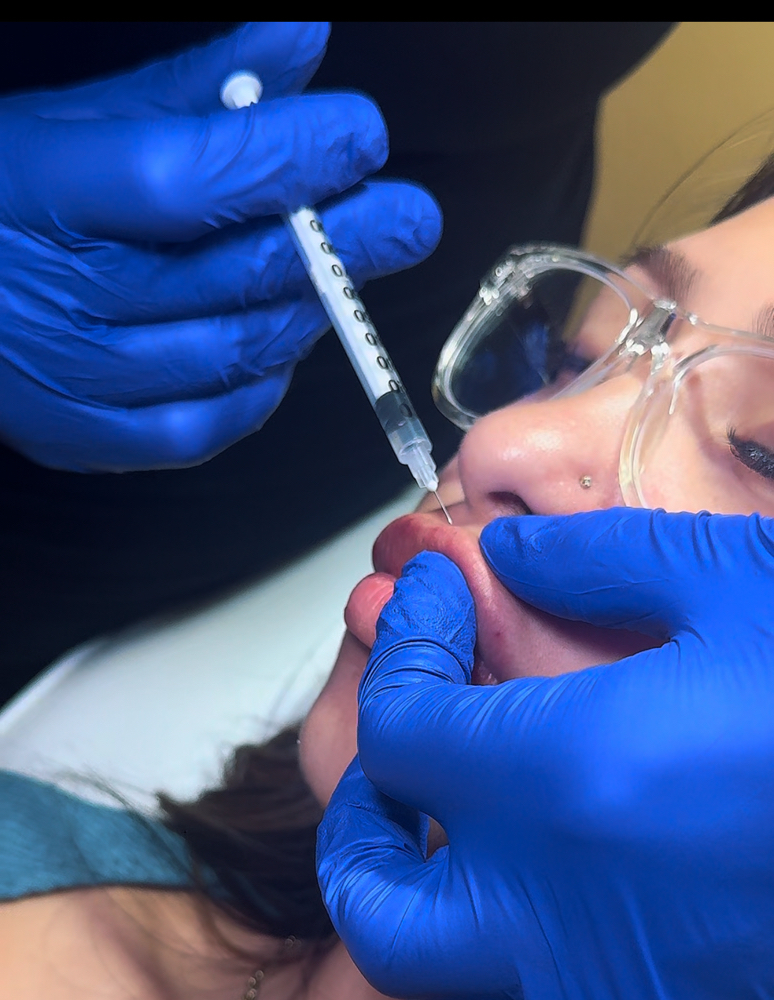 Needle Only Filler
