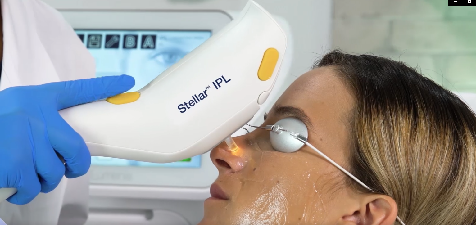 ✨ New Patients – IPL 3 Sessions