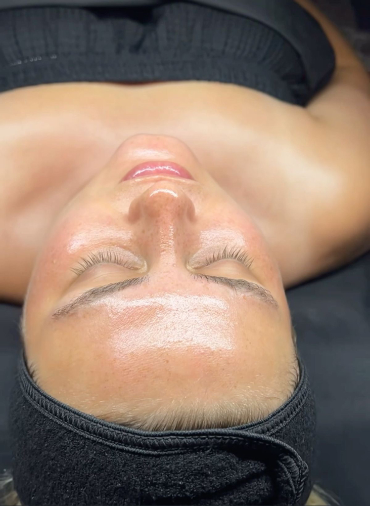 Jenasus Growth Factor Chemical Peel