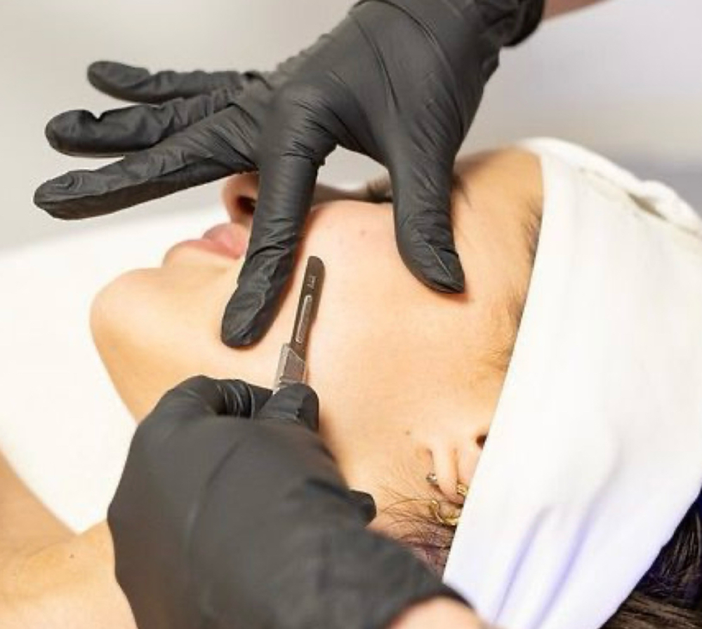 Dermaplaning Facial