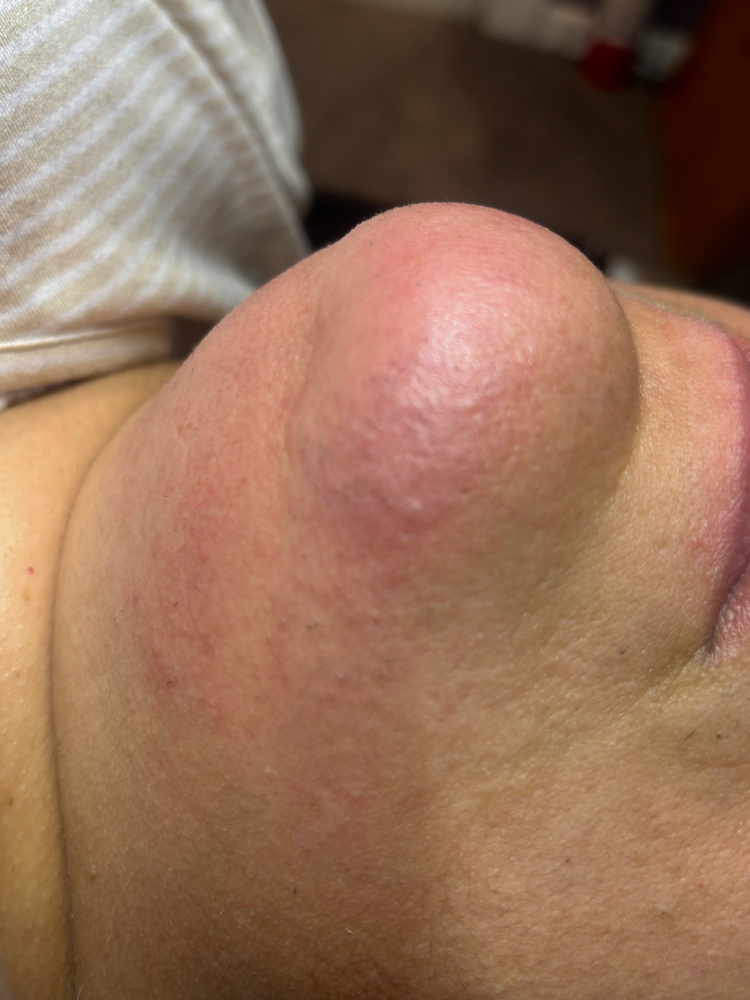 Chin Wax at B YOURBEAUTY in Aurora, IL